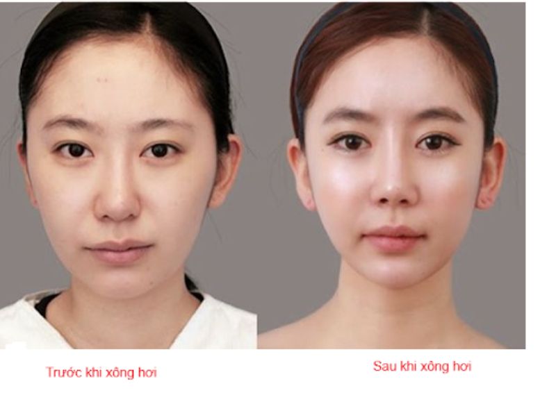 Xông hơi có giảm mỡ mặt không, trước và sau khi xông hơi mặt